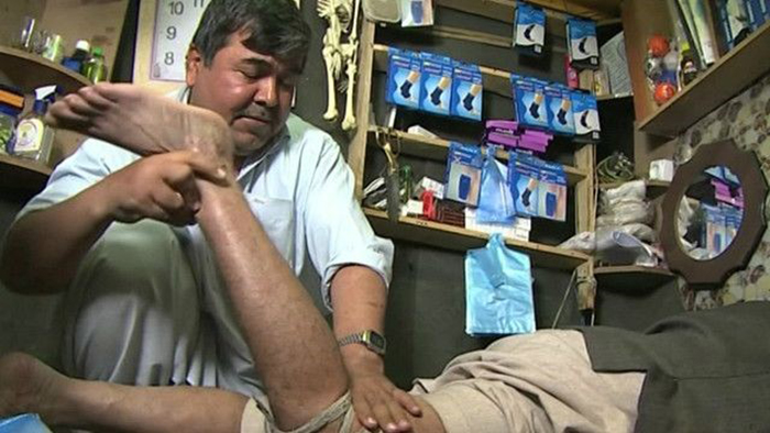 شکسته‌بندها راست می‌کند یا کج؟