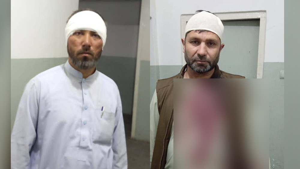 لت‌وکوب یک داکتر و یک راننده در پروان